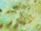Abrothallus parmeliarum (Sommerf.) Arnold