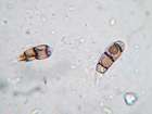 Arthonia phaeophysciae Grube & Matzer