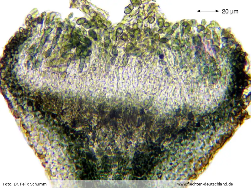 Fruchtkörper | Foto von Dr. Felix Schumm
