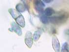 Calicium adspersum Pers.