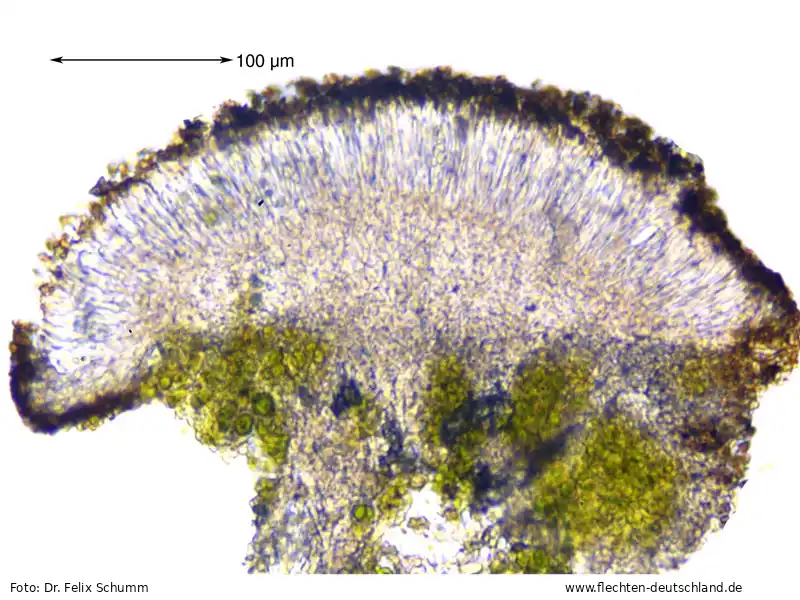 Fruchtkörper | Foto von Dr. Felix Schumm