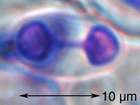 Caloplaca microthallina (Wedd.) Zahlbr.