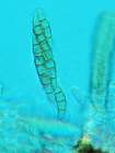 Cercidospora cladoniicola Alstrup