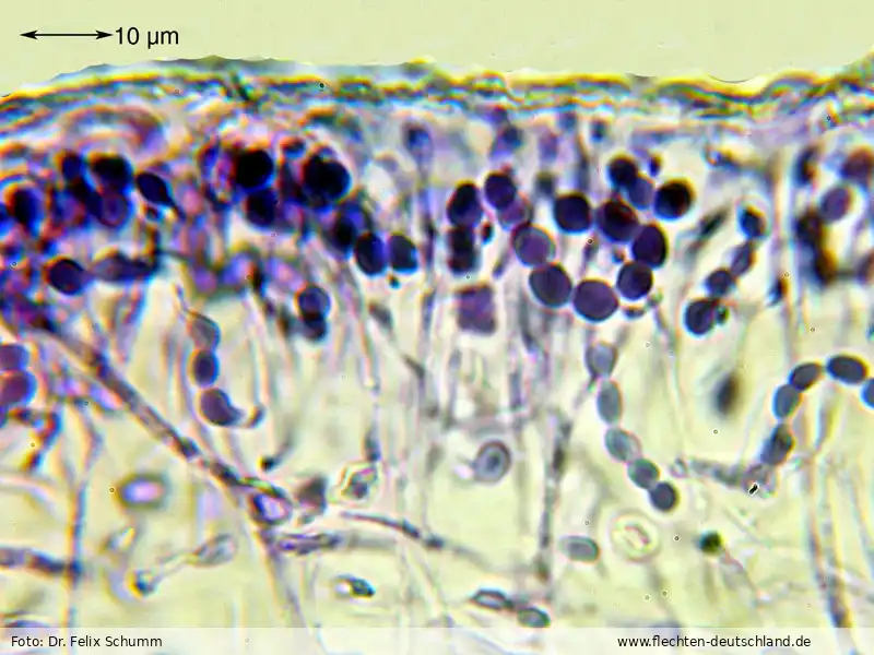 Mikromerkmale | Foto von Dr. Felix Schumm