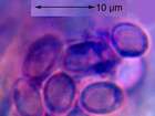 Lecanora sambuci (Pers.) Nyl.