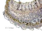 Lobaria virens (With.) J. R. Laundon