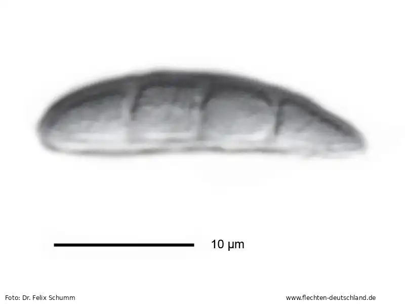 Querschnitt Fruchtkörper | Foto von Dr. Felix Schumm