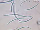 Micarea peliocarpa (Anzi) Coppins & R. Sant.