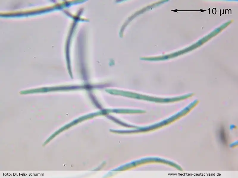 Querschnitt Fruchtkörper | Foto von Dr. Felix Schumm