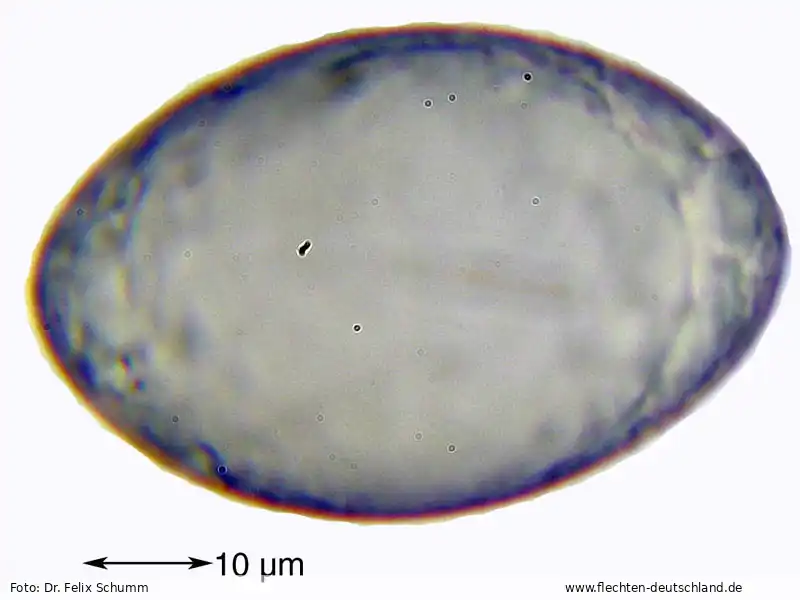 Querschnitt Fruchtkörper | Foto von Dr. Felix Schumm