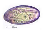 Ochrolechia szatalaensis Verseghy