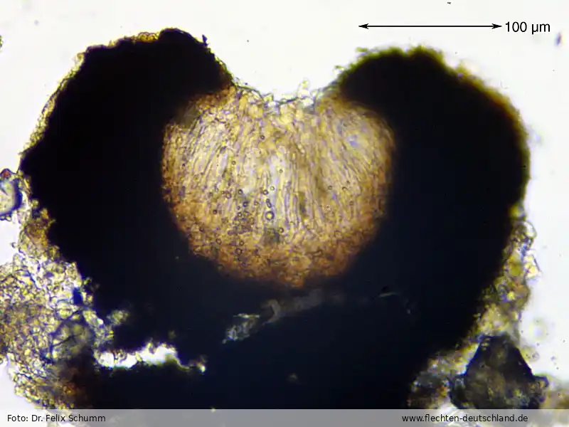 Fruchtkörper | Foto von Dr. Felix Schumm