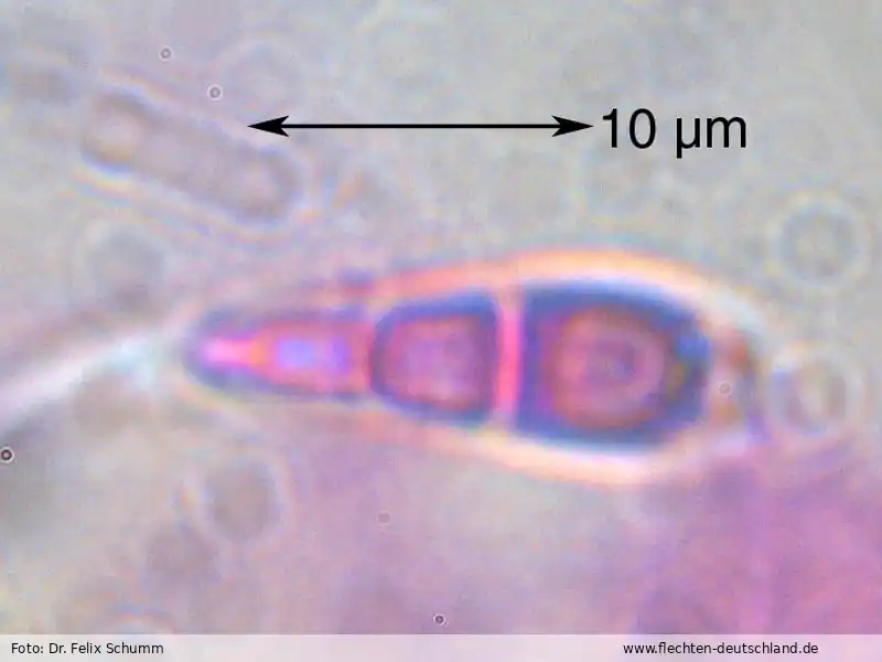 Querschnitt Fruchtkörper | Foto von Dr. Felix Schumm