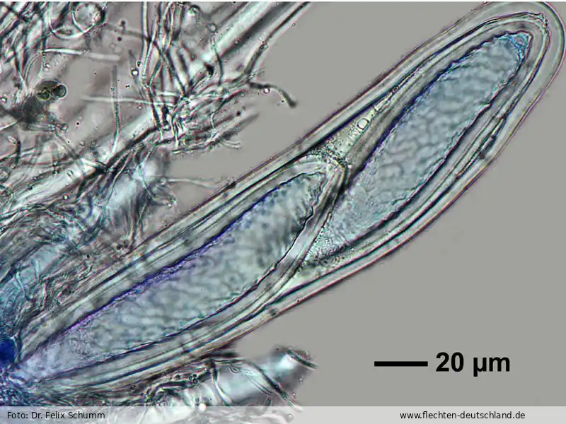 Ascus/Basidie | Foto von Dr. Felix Schumm