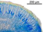 Caloplaca erythrocarpa (Pers.) Zwackh